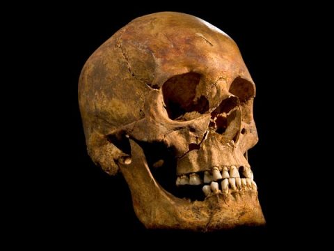 The skull of Richard III